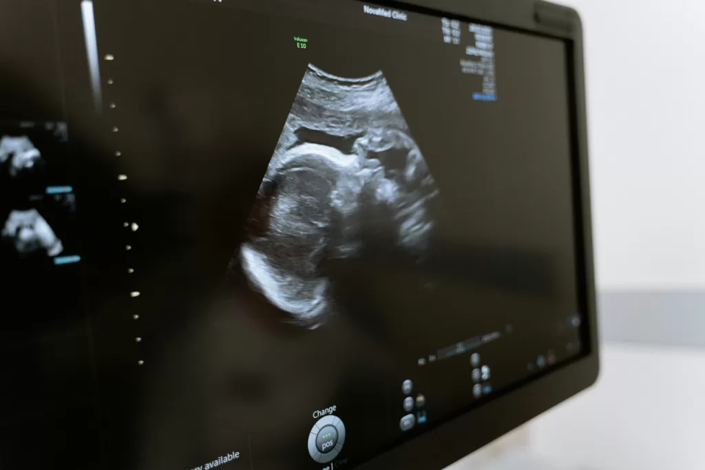 My Services: An ultrasound image displaying the unborn baby on the screen.